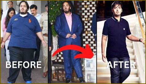 Anant Ambani's Journey: Battling A Rare Disease With Courage